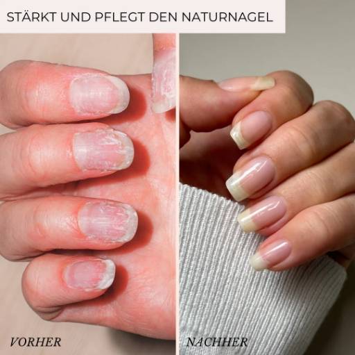 02_Kollektionen/INSIDE Unterschiede/hand.jpg